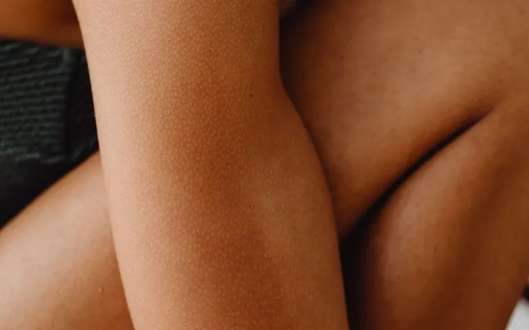 Close-up of bare skin with a textured, bumpy surface in soft natural light