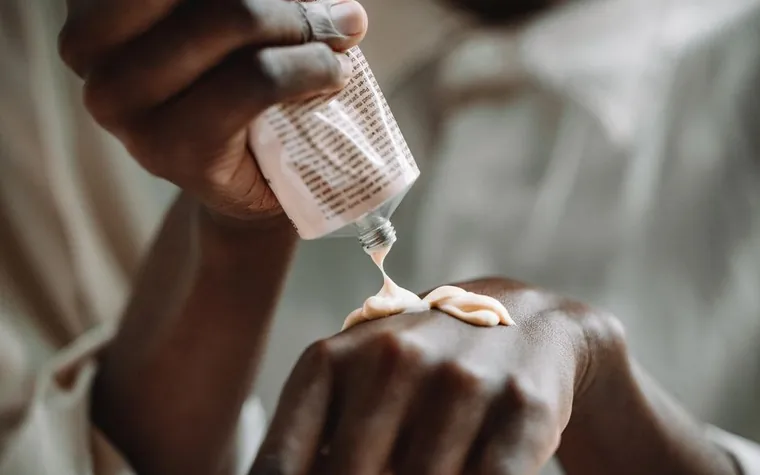 Close-up of hands applying moisturizing cream from a tube