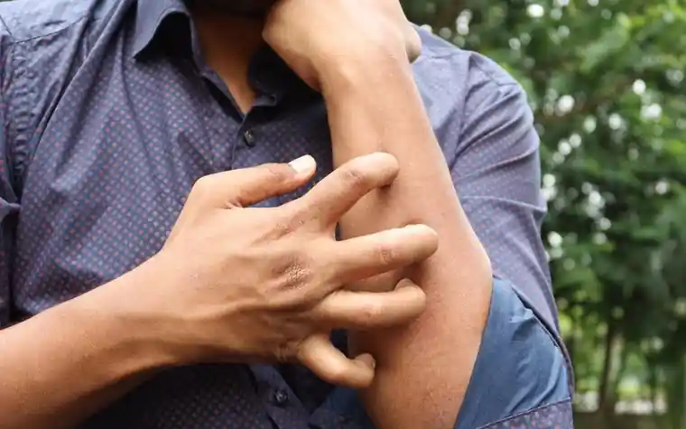 Close-up of a person scratching an itchy arm outdoors