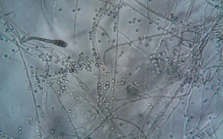 Microscopic view of fungal hyphae and spores