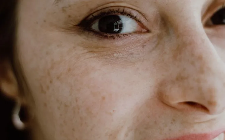 Extreme close-up of a woman's eye, freckled cheek, and skin texture