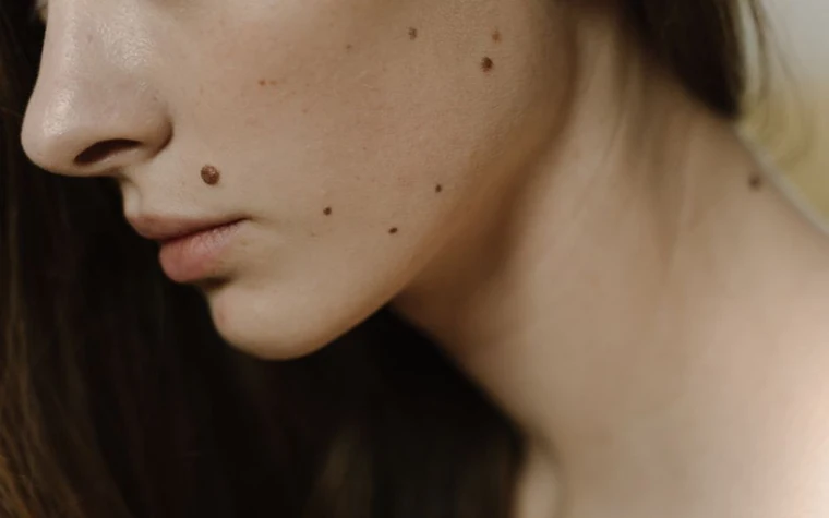 Close-up of a person's clear skin during a skincare consultation