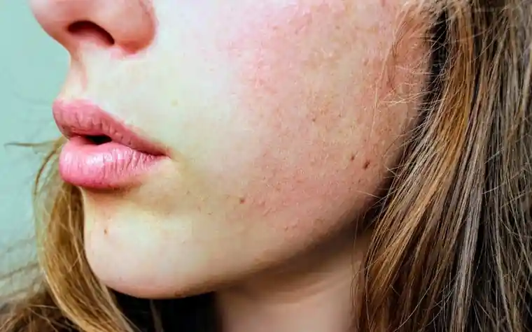 Close-up of a woman's cheek with well-moisturised skin